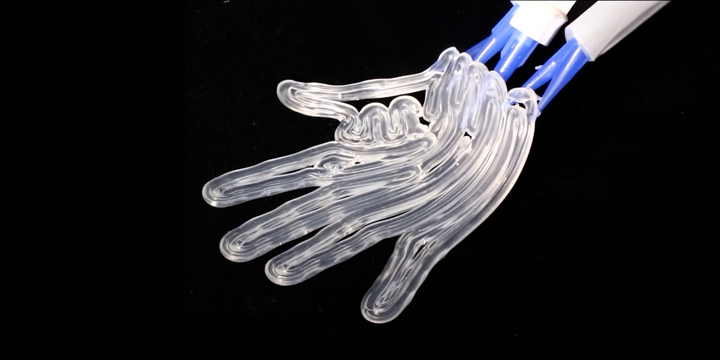 Muscoli di gel e aria compressa: la stampa 3D che accelera la produzione di protesi